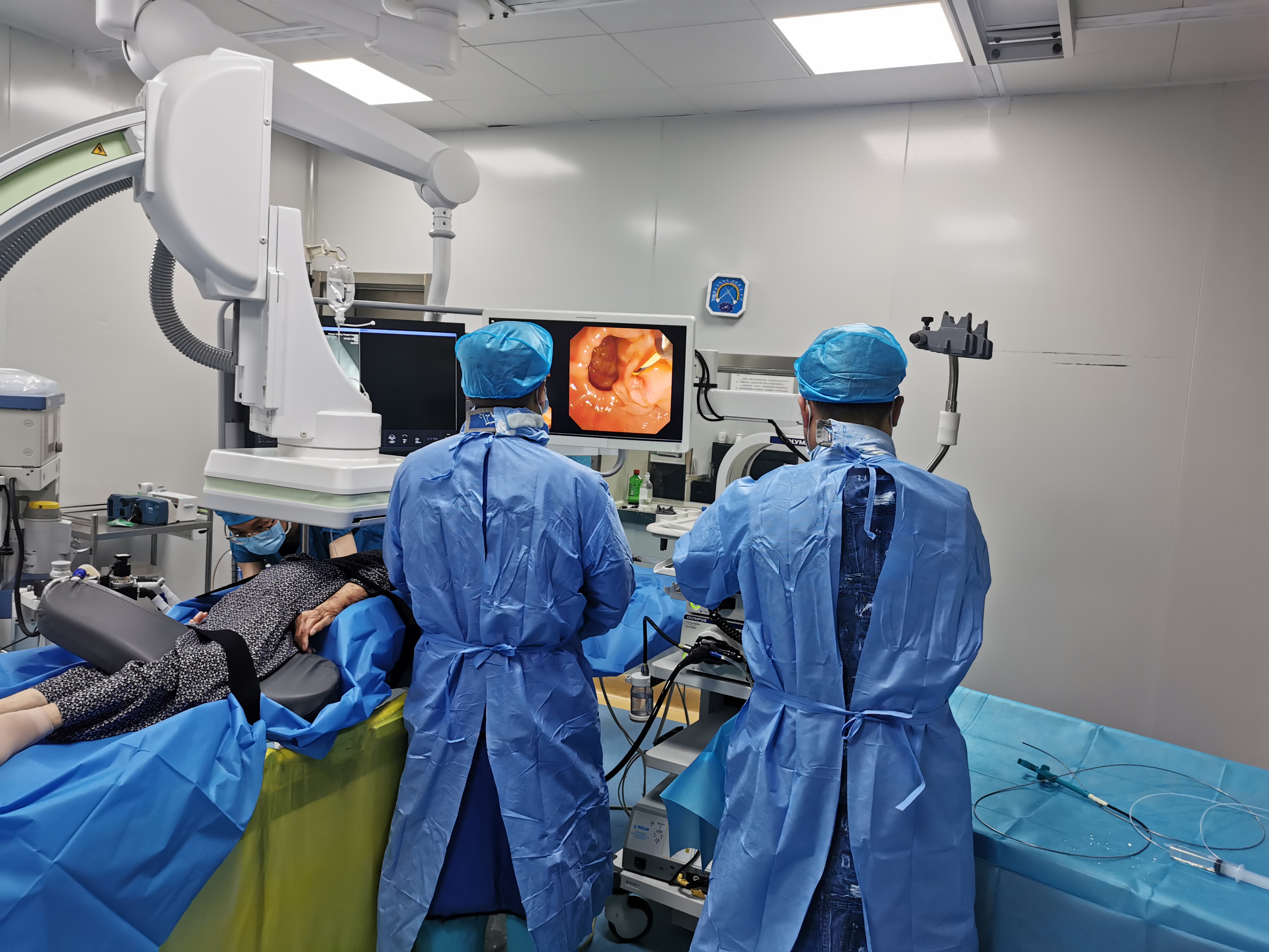 汉阴县人民医院消化内科完成高龄患者胆管结石内镜下取石术